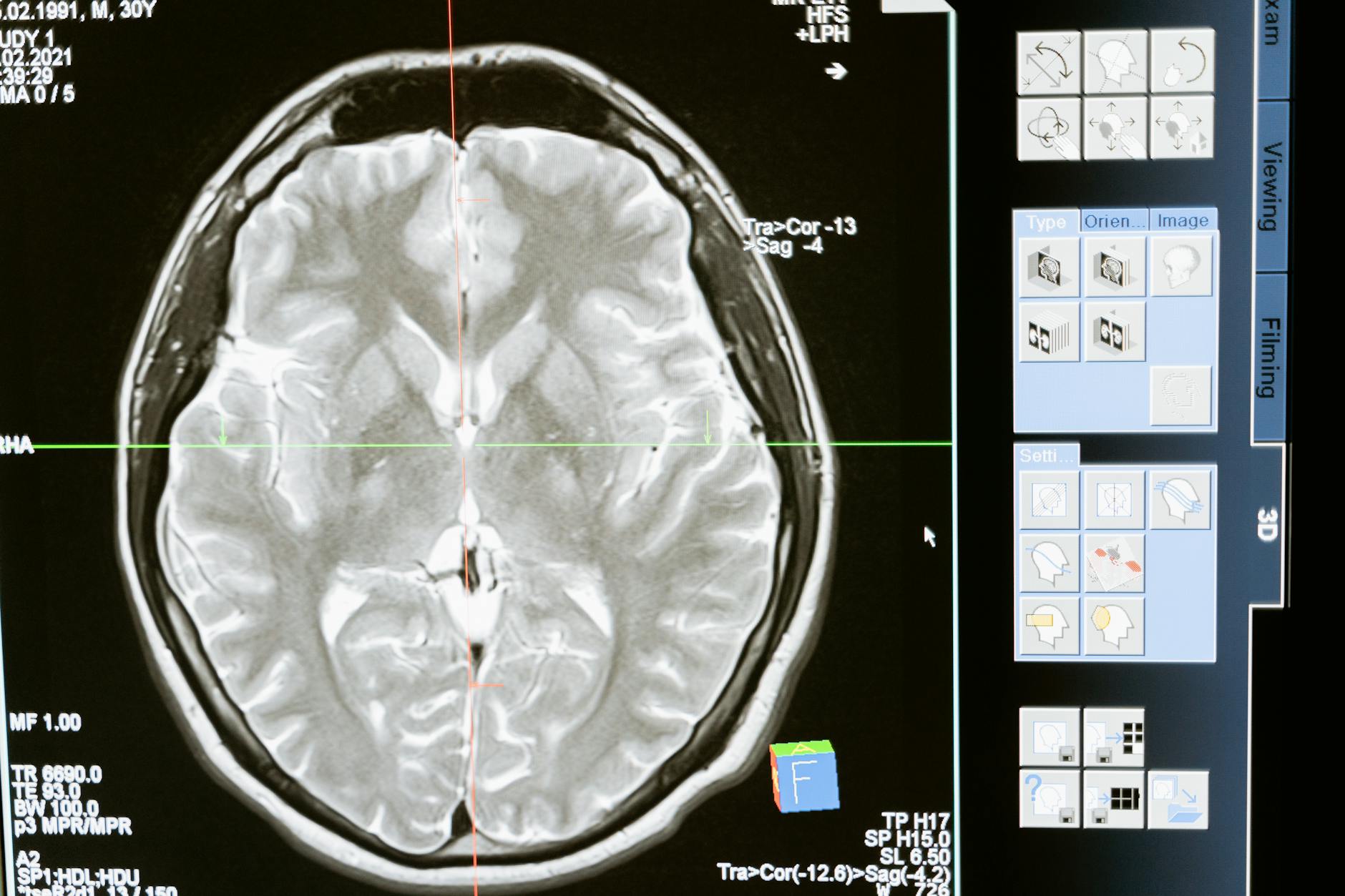 Kostenloses Stock Foto zu 'digital-image', analyse, anatomie